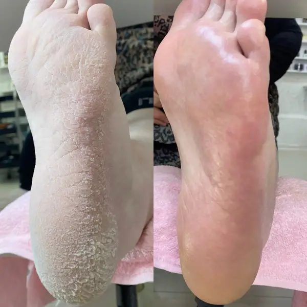 کفسابی پا آقایان
