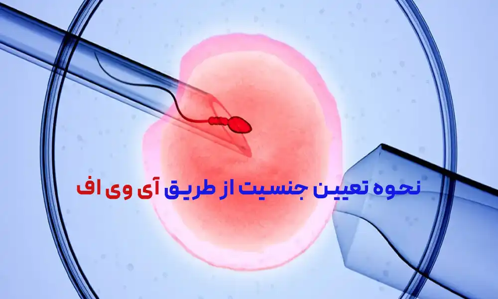 نحوه تعیین جنسیت از طریق آی وی اف